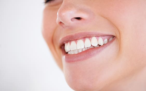 Dental Fillings in Northwest (NW) Calgary